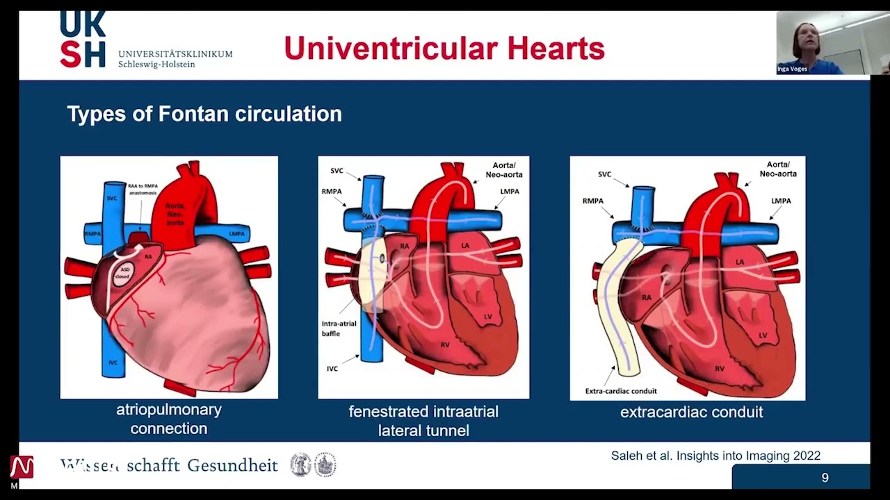 Metrics of the heart - medisimaging