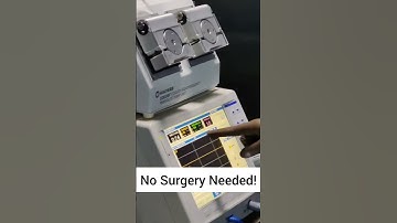 New Treatment For Knee Pain Without Surgery MIPSI PROCEDURE- COOLED RFA of Genicular Nerves