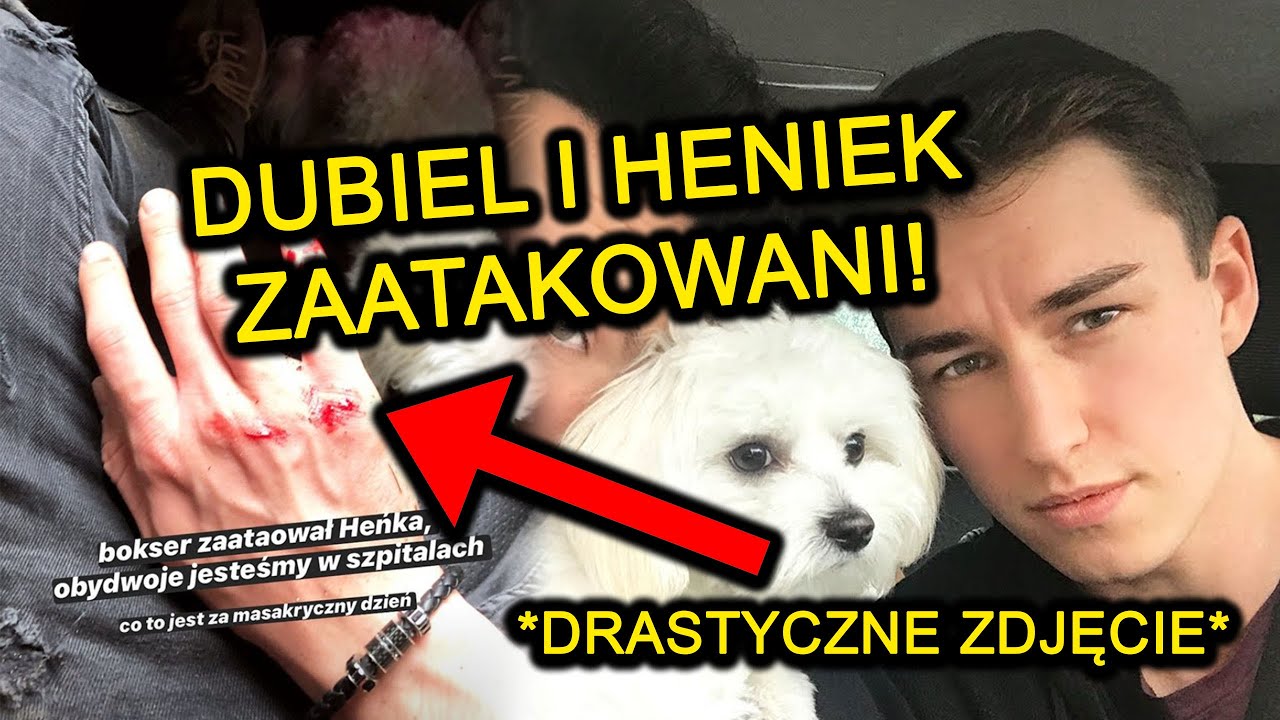 MARCIN DUBIEL I HENIEK POGRYZIENI PRZEZ AGRESYWNEGO PSA ...