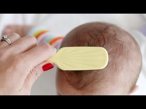 فيديو: لماذا لا ينمو طفلي شعره؟