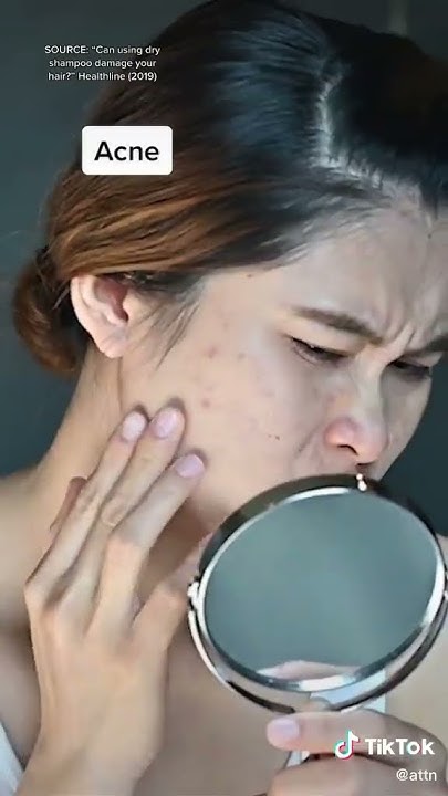 can-dry-shampoo-make-your-hair-fall-out-youtube