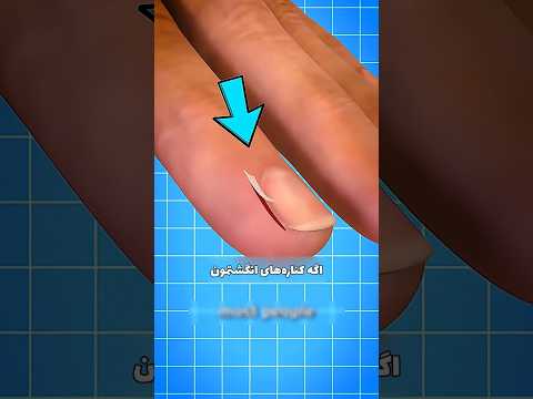 اگه کناره های انگشتمون پوسته پوسته شد چیکار کنیم دانستنی سرگرمی