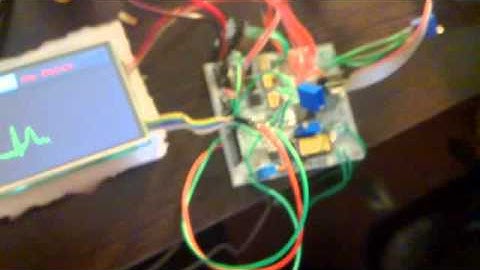 EKG/ECG signals on touch LCD screen