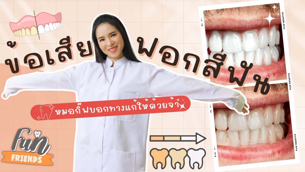 ข้อเสียฟอกสีฟัน คุณหมอบอกหมดไม่กั๊ก พร้อมบอกวิธีแก้! |FunFriends เพื่อนกันฟันดี|