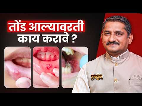 पोटातील उष्णता आणि तोंड येणे यावर घरगुती उपाय | Mouth Ulcers reason explained | Dr.Harish Patankar