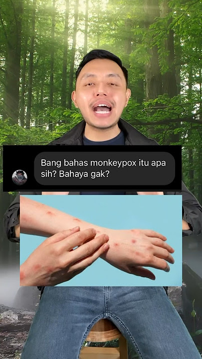 Monkeypox itu apa? Bahaya gak? Udah masuk Indonesia? #shorts