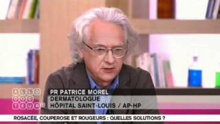 Dermite Séborrhéique