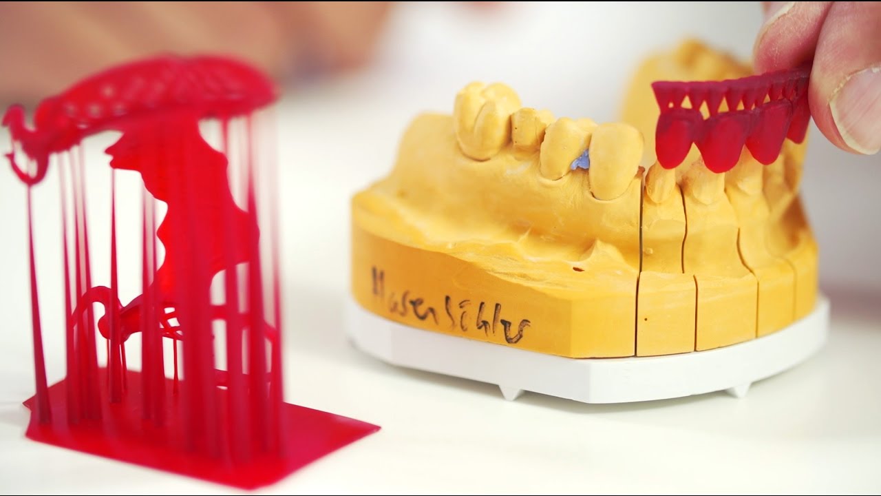 3D Druck im Dentallabor: Dentale Gusstechnik - digitale Herstellung von Casts mit Freeprint® cast