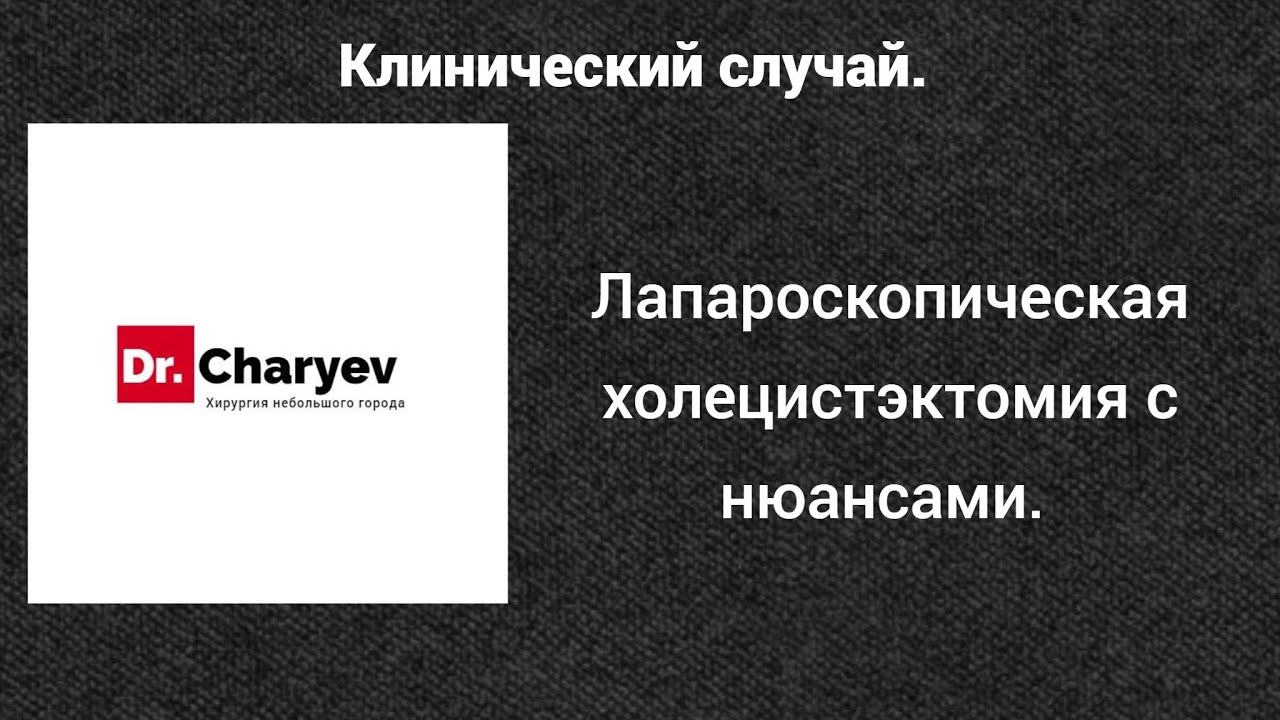 Клинический Случай. Лапароскопическая холецистэктомия с нюансами. - YouTube