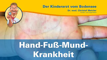 Wie oft kann man die Hand-Fuß-Mund-Krankheit bekommen?