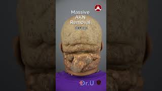 Pov Reggies Battle With Akn Was One Of The Toughest, Until He Met Dr.u シ