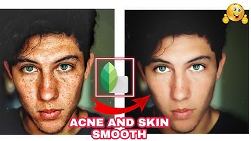 SNAPSEED SMOOTH SKIN AND PIMPLES REMOVING TRICKS ❣️ TOOLS AND TRICKS ✌️JUST FOLLOW