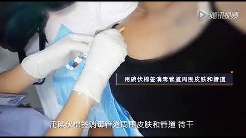 How to use the PICC line shower shield
