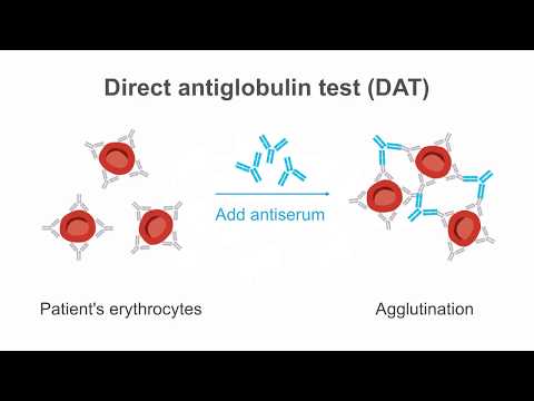 Recognizing the significance of poikilocytes