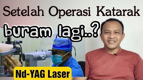 Setelah Operasi Katarak Kenapa Mata Buram Lagi | Katarak Sekunder