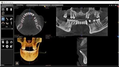 CS 3D Imaging   Creating a Reconstructed Panoramic Image