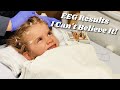 EEG Results! | I Can't Believe It! | New Smile