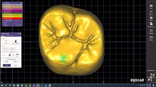 How To Repair A Broken Tooth Shape In Exocad Dental Cad Tips