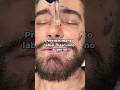 Preenchimento labial masculino superior