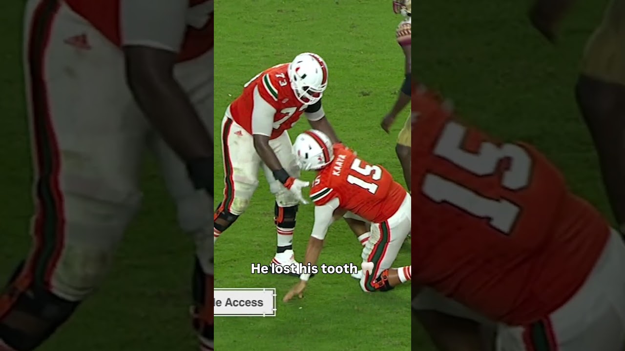 The tooth was recovered π
#miamihurricanes #accfootball #collegefootball