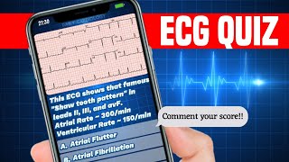 ECG quiz by Daily Cardiology | Become an ECG Master 