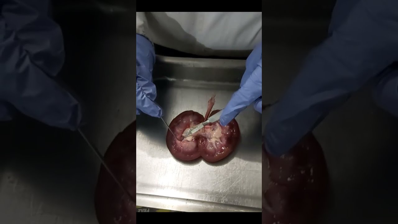 ASSIGNMENT: DISSECTION OF A MAMMALIAN KIDNEY - TONI OLIVER  - 23208569