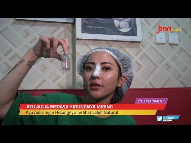 Ayu Aulia Operasi Hidung Hingga Delapan Kali