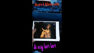 USG 12 Minggu bayi ini angkat angkat kaki lucu sekali