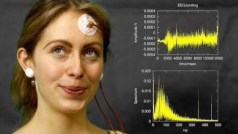 EEG artefacts: 