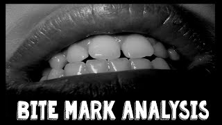 What is Bite Mark Analysis?