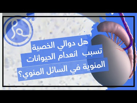 دوالي الخصية و أنعدام الحيوانات المنوية ف السائل المنوي