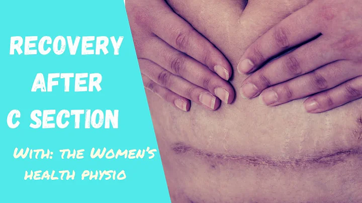 THE 8 BEST C SECTION RECOVERY TIP | with Physiothe...