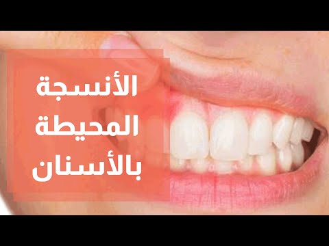 الأنسجة المحيطة بالأسنان وعلاقتها بتجميل الأسنان