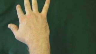 ulnarmidcarpalclunk