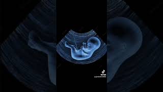 Mojep Rannki Roberta Velka