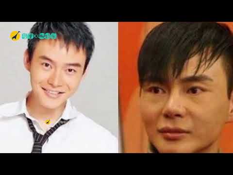 4位大方承认整容的男星！第二位迫不得已，最后一位是为艺术献身