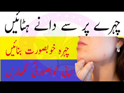 Face Pimples Removal - Acne and Blackheads Pimples also Cystic Acne Removal On Face Fast Removed