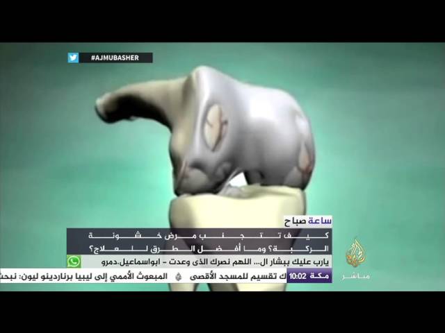 "خشونة مفاصل الركبة " هل هو مقترن بالتقدم في السن ؟ - ساعة صباح