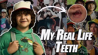 Celebrity Dustin Henderson Teeth in Real Life| Gaten Matarazzo Teeth disease| Stranger Things Cast Facts Profile