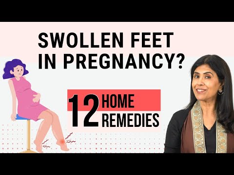 12 Home Remedies