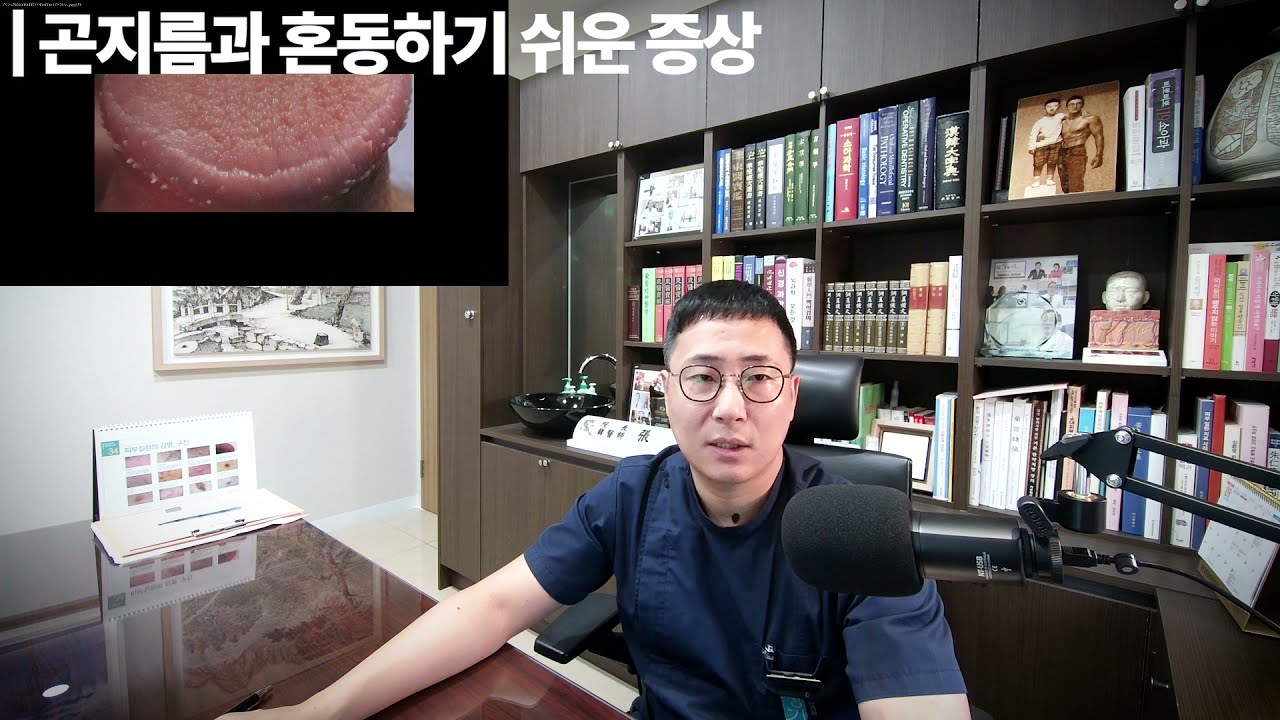 곤지름(성기사마귀)와 착각하기 쉬운 증상 - Youtube