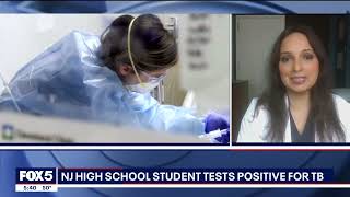 NJ High School Student Tests Positive for Tuberculosis (3-20-25)