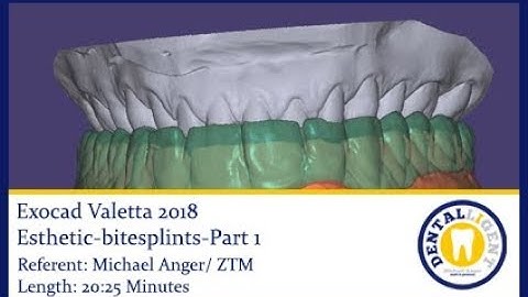 Dentalligent - Exocad-Valetta-2018-esthetic-bitesplints-Part1 / PREVIEW