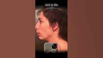 3 Months Transformation #looksmaxxing