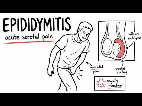 Epididymitis Explained | Causes, Symptoms, Diagnosis and Treatment thumbnail