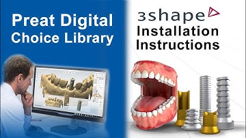 3shape - How to Install Your Preat Digital Choice Library