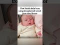 A miracle:How a womb from a dead donor helped give life to the first British baby. #shorts