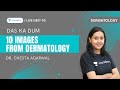 Das ka Dum | 10 Image based question in dermatology ( INI-CET )  | Dr. Chesta Agarwal