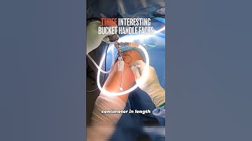 UNLOCK Bucket Handle Meniscus Tear Secrets⁉️