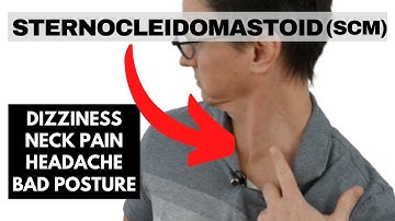 Sternocleidomastoid (SCM): neck pain, headaches, and cervicogenic dizziness